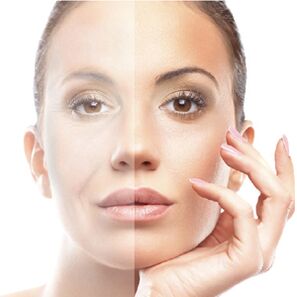Rejuvenation nke anụ ahụ